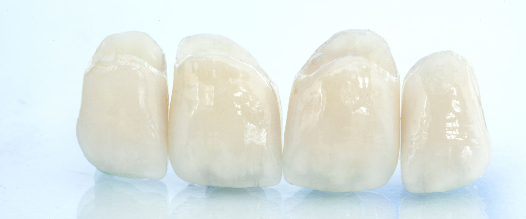 つめ物・かぶせ物